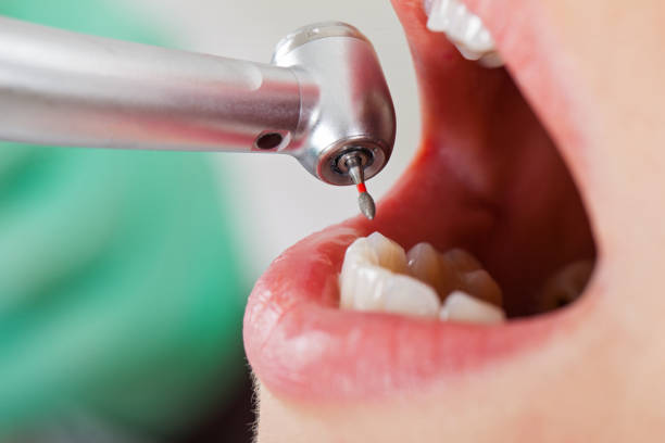 Dentist for Dental Trauma in WI
